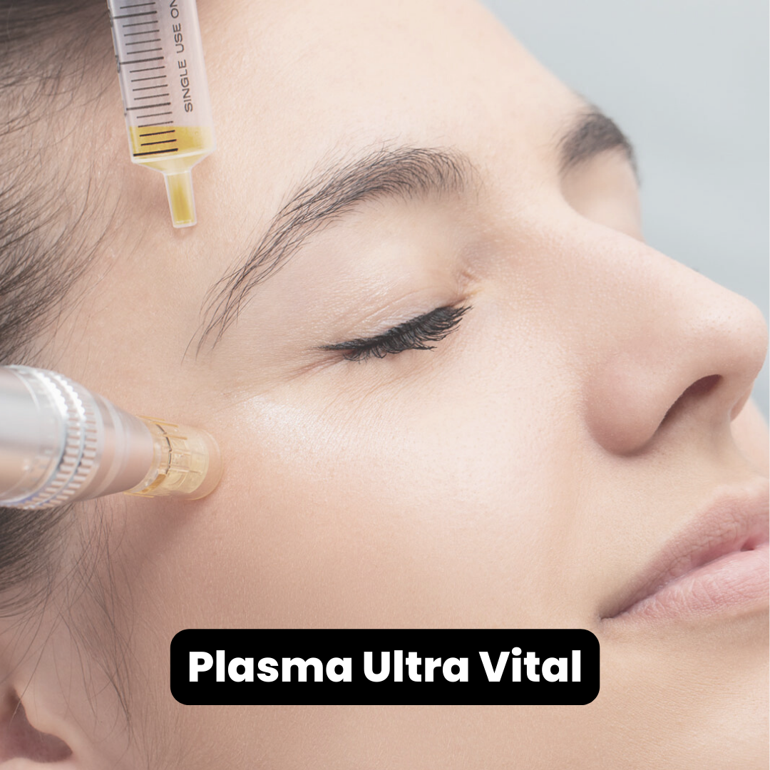 Plasma Ultra Vital