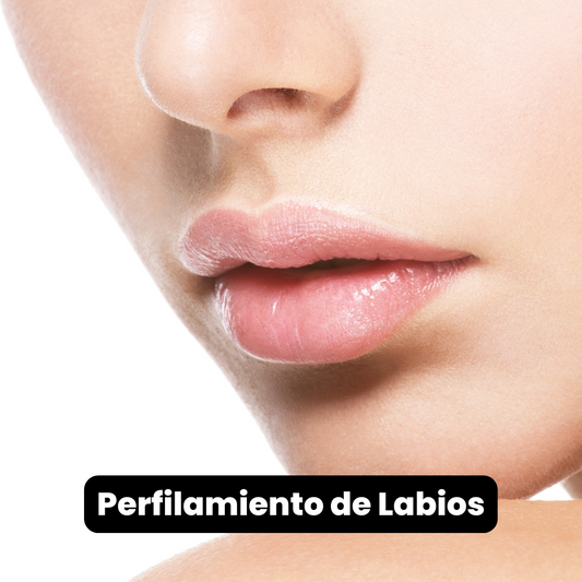 Perfilamiento de Labios con Ácido Hialurónico